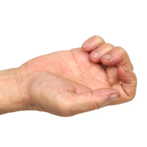 photograph showing a hand with trigger finger.