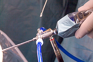 photograph of arthroscopic equipment.