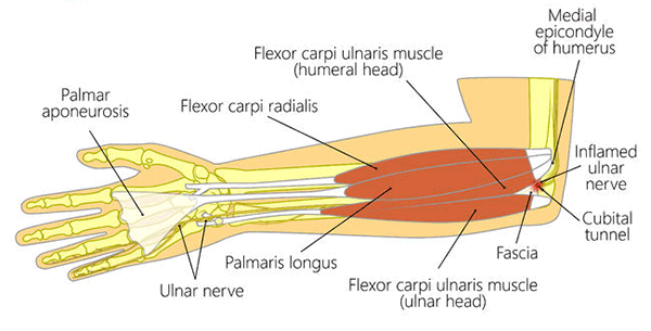 Diagram showing the anatomy of the hand and lower arm.